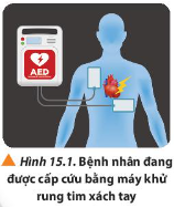 Máy khử rung tim xách tay là thiết bị được các đội y tế thường dùng để cấp cứu bệnh nhân bị rối loạn nhịp tim và tạo nhịp tim ổn định cho bệnh nhân...